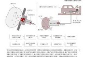 汽车安全气囊概述知乎-汽车安全气囊介绍